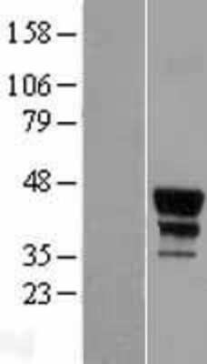 Western Blot: MEIS2 Overexpression Lysate [NBL1-13004]