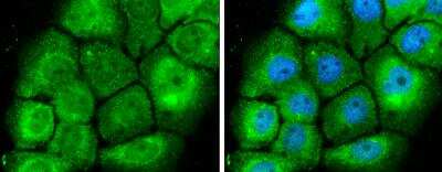 Immunocytochemistry/ Immunofluorescence: MEK1 Antibody [NBP2-17265]