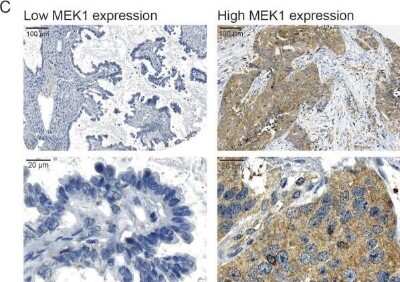 Immunohistochemistry: MEK1 Antibody [NBP1-87790]