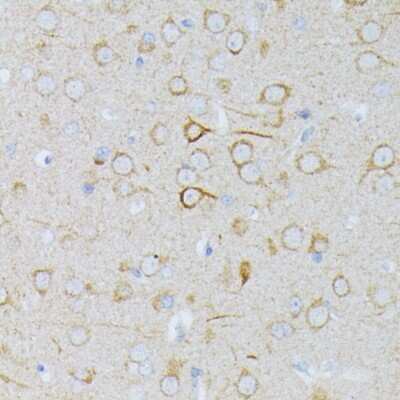 Immunohistochemistry: MEK1 Antibody - Azide and BSA Free [NBP3-02951]