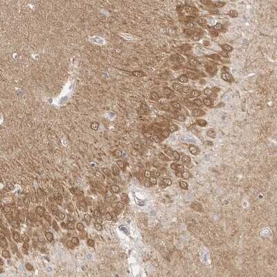 Immunohistochemistry-Paraffin: MEK1 Antibody [NBP1-87790]