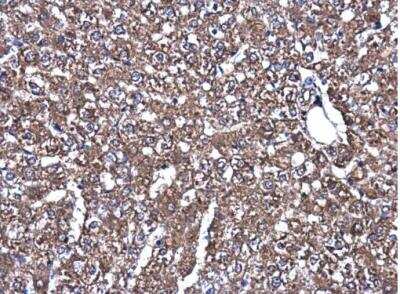 Immunohistochemistry-Paraffin: MEK1 Antibody [NBP2-17265]