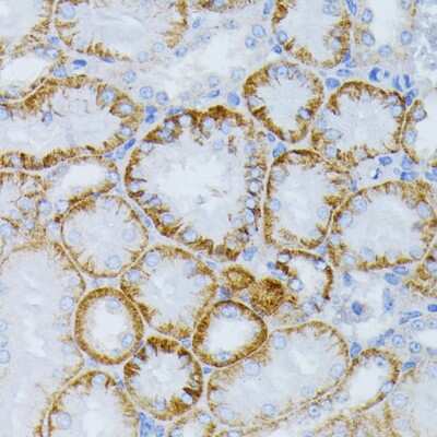 Immunohistochemistry-Paraffin: MEK1 Antibody - Azide and BSA Free [NBP3-02951]