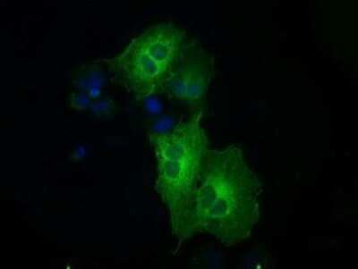 Immunocytochemistry/ Immunofluorescence: MEK1 Antibody (OTI1F5) - Azide and BSA Free [NBP2-72643]