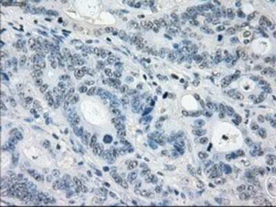 Immunohistochemistry: MEK1 Antibody (OTI1F5) - Azide and BSA Free [NBP2-72643]