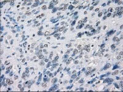 Immunohistochemistry: MEK1 Antibody (OTI1F5) - Azide and BSA Free [NBP2-72643]