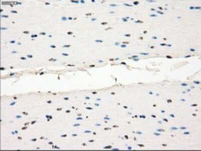 Immunohistochemistry: MEK1 Antibody (OTI1F5) - Azide and BSA Free [NBP2-72643]