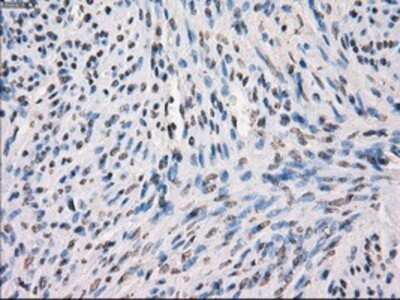 Immunohistochemistry: MEK1 Antibody (OTI1F5) - Azide and BSA Free [NBP2-72643]