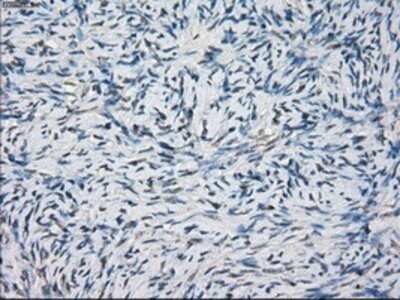 Immunohistochemistry: MEK1 Antibody (OTI1F5) - Azide and BSA Free [NBP2-72643]