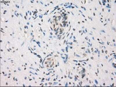 Immunohistochemistry: MEK1 Antibody (OTI1F5) - Azide and BSA Free [NBP2-72643]