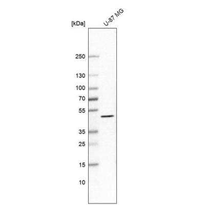 Western Blot: MEK1 Antibody [NBP1-87790]