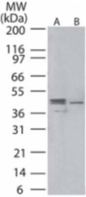 Western Blot: MEK1 [p Ser218, p Ser222] Antibody [NBP2-24542]