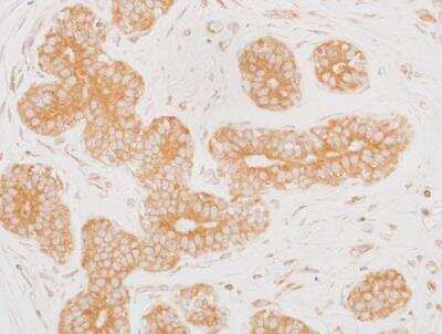 Immunohistochemistry-Paraffin: MEK2 Antibody (BLR079G) [NBP2-78800]