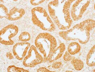 Immunohistochemistry-Paraffin: MEK2 Antibody (BLR079G) [NBP2-78800]