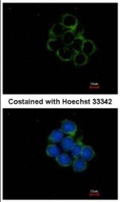 Immunocytochemistry/ Immunofluorescence: MEK2 Antibody [NBP2-17268]