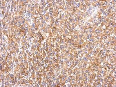 Immunohistochemistry-Paraffin: MEK2 Antibody [NBP2-17268]