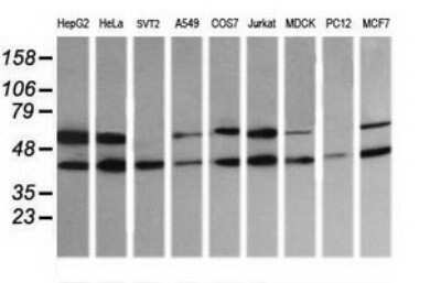 Western Blot: MEK2 Antibody (OTI1A2)Azide and BSA Free [NBP2-72647]