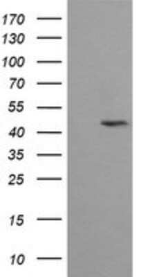 Western Blot: MEK2 Antibody (OTI1A2)Azide and BSA Free [NBP2-72647]