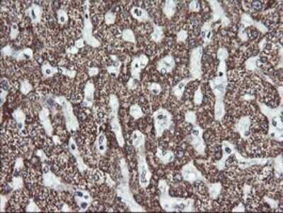 Immunohistochemistry: MEK2 Antibody (OTI1A2) [NBP2-45802]