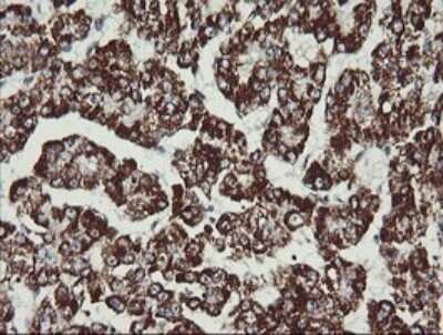 Immunohistochemistry: MEK2 Antibody (OTI1A2) [NBP2-45802]