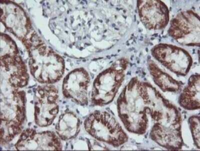 Immunohistochemistry: MEK2 Antibody (OTI1A2) [NBP2-45802]