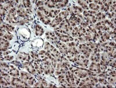 Immunohistochemistry: MEK2 Antibody (OTI1A2) [NBP2-45802]