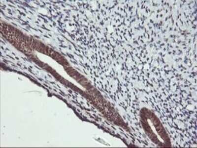 Immunohistochemistry: MEK2 Antibody (OTI1A2) [NBP2-45802]