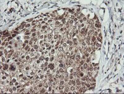 Immunohistochemistry: MEK2 Antibody (OTI1A2) [NBP2-45802]
