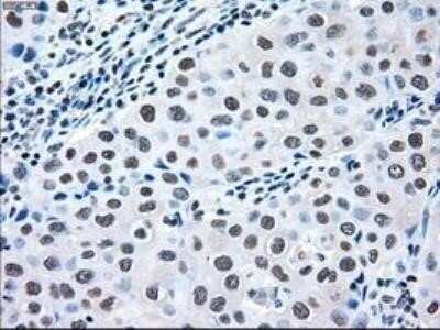 Immunohistochemistry: MEK2 Antibody (OTI8G6) - Azide and BSA Free [NBP2-72646]