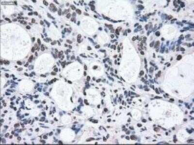 Immunohistochemistry: MEK2 Antibody (OTI8G6) - Azide and BSA Free [NBP2-72646]
