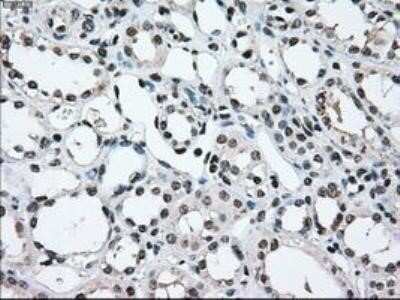 Immunohistochemistry: MEK2 Antibody (OTI8G6) - Azide and BSA Free [NBP2-72646]