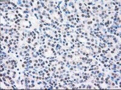 Immunohistochemistry: MEK2 Antibody (OTI8G6) - Azide and BSA Free [NBP2-72646]
