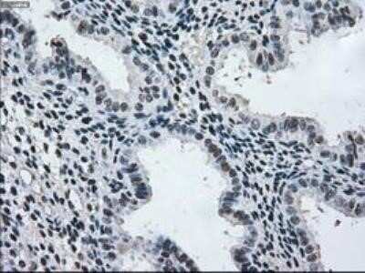 Immunohistochemistry: MEK2 Antibody (OTI8G6) - Azide and BSA Free [NBP2-72646]
