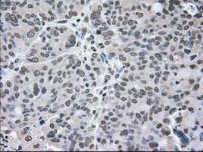 Immunohistochemistry: MEK2 Antibody (OTI8G6) - Azide and BSA Free [NBP2-72646]