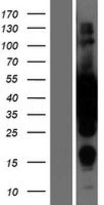 Western Blot: MEK2 Overexpression Lysate [NBL1-12847]