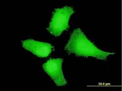 Immunocytochemistry/ Immunofluorescence: MEK5 Antibody (1B4) [H00005607-M07]