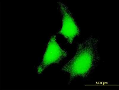 Immunocytochemistry/ Immunofluorescence: MEK5 Antibody (1E5) [H00005607-M03]