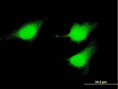 Immunocytochemistry/ Immunofluorescence: MEK5 Antibody (2C2) [H00005607-M04]