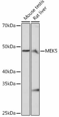 Western Blot: MEK5 Antibody (7B7O10) [NBP3-15451]