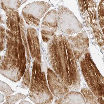 Immunohistochemistry-Paraffin: MEK5 Antibody [NBP1-89655]