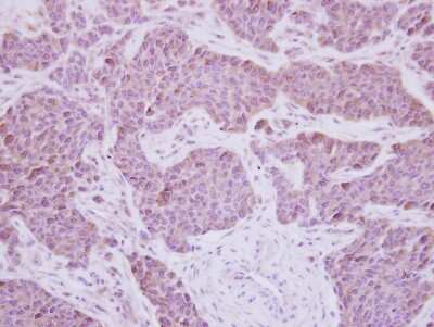 Immunohistochemistry-Paraffin: MEK5 Antibody [NBP2-17270]