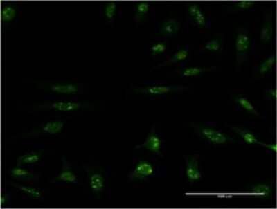 Immunocytochemistry/ Immunofluorescence: MEK5 Antibody (M1-E6) [H00005607-M01]