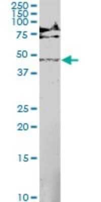 Western Blot: MEK5 Antibody (M1-E6) [H00005607-M01]
