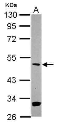 Western Blot: MEK5 Antibody [NBP2-17270]