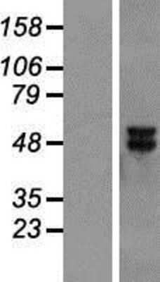 Western Blot: MEK5 Overexpression Lysate [NBP2-05497]