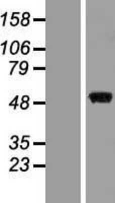 Western Blot: MKK7/MEK7 Overexpression Lysate [NBP2-05503]