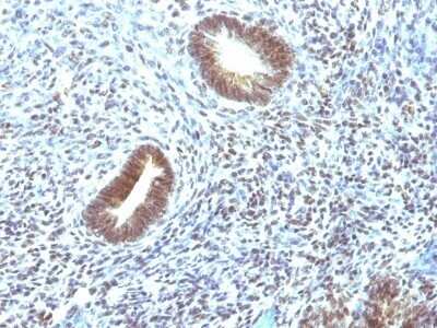 Immunohistochemistry-Paraffin: MEKK1 Antibody (2F6) - Azide and BSA Free [NBP2-47810]