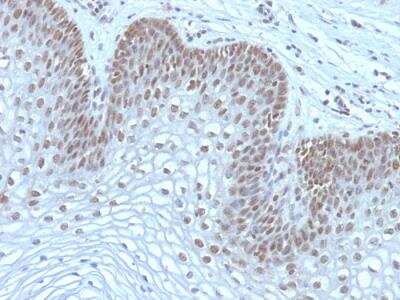 Immunohistochemistry-Paraffin: MEKK1 Antibody (2F6) - IHC-Prediluted [NBP2-48208]