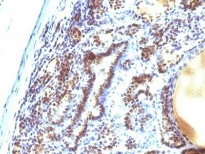 Immunohistochemistry-Paraffin: MEKK1 Antibody (2F6) [NBP2-44405]