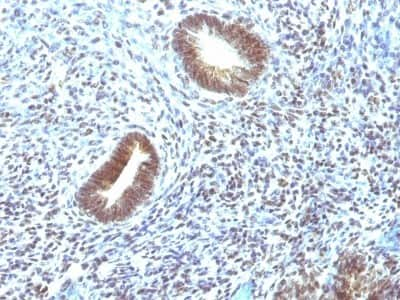 Immunohistochemistry-Paraffin: MEKK1 Antibody (2F6) [NBP2-44405]